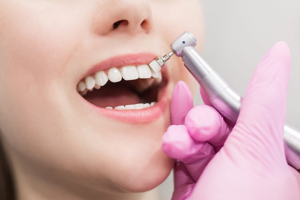 Dublin-tooth-whitening-Dentist-Drumcondra-Glasnevin-1